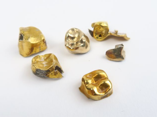 Lot d'or dentaire. Poids : 11,22 g