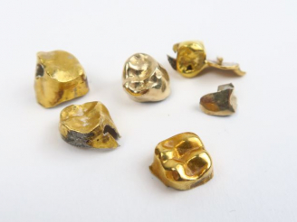 Vente aux enchères Lot d'or dentaire. Poids : 11,22 g