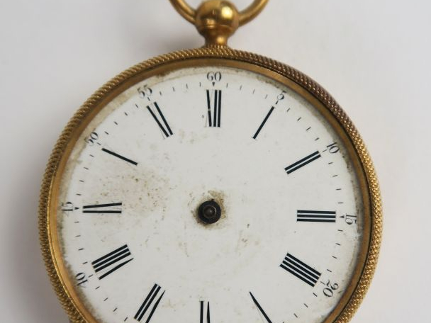 Montre de gousset accidentée en or. Poids tel : 48 g