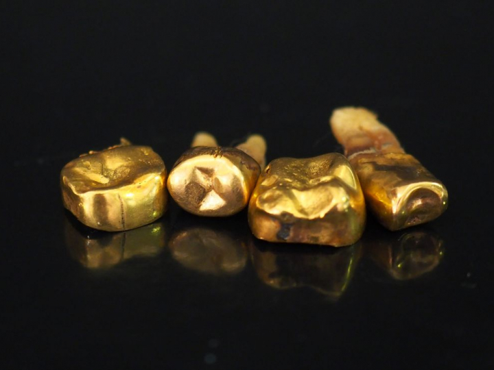 Dents en or.  Poids tel. 7,15 g   