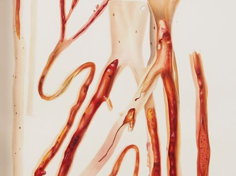 [MÉDECINE]. LEBERT (Hermann). TRAITÉ D’ANATOMIE PATHOLOGIQUE GÉNÉRALE 