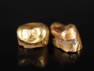 Vente aux enchères Or dentaire.  Poids. 2,98 g